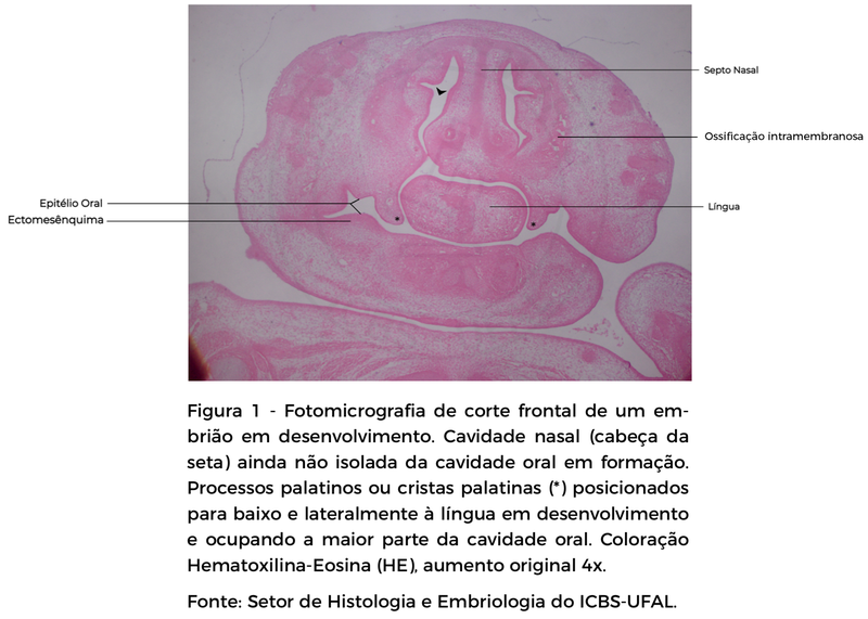 FIGURA 1