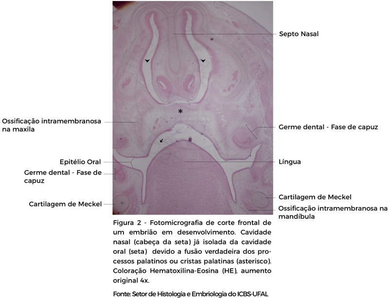 FIGURA 2