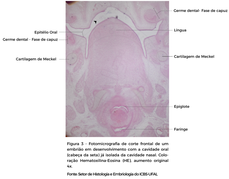 FIGURA 3