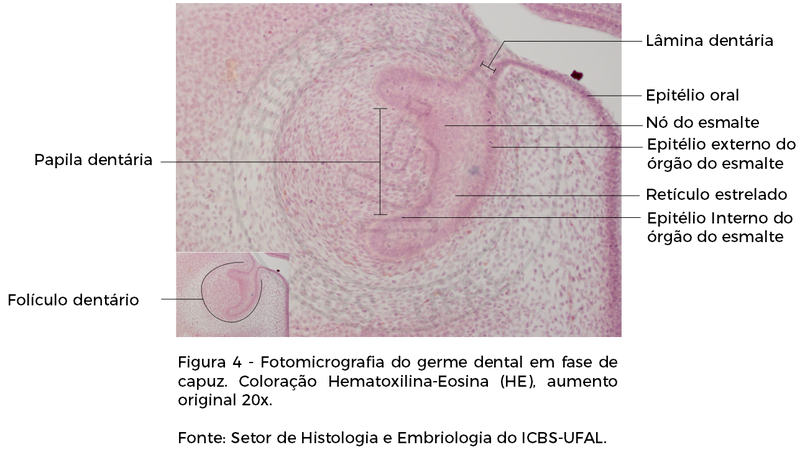 FIGURA 4