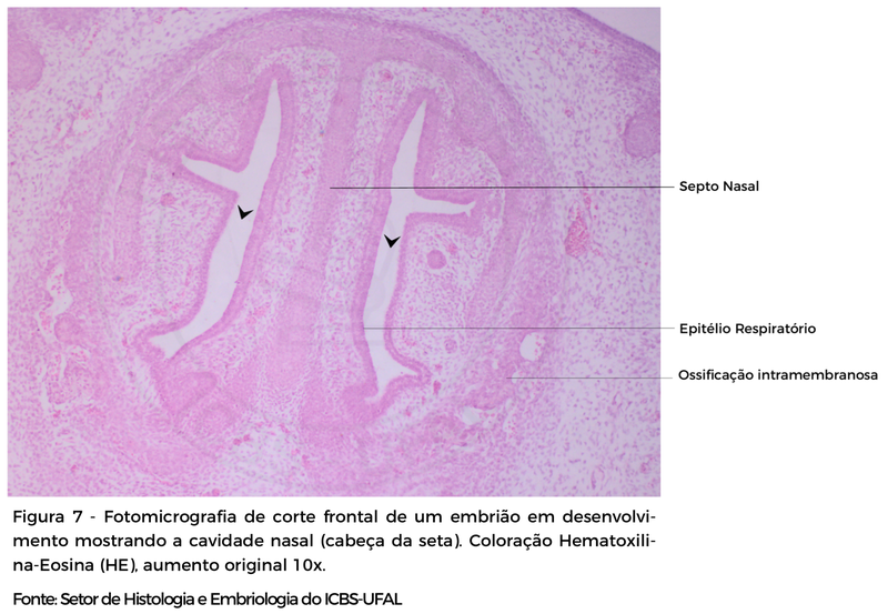 FIGURA 7